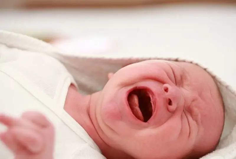 triệu chứng bệnh colic